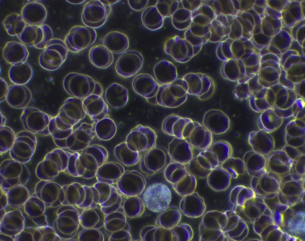 Live Blood Analysis Microscopes — Microscopes.com.au