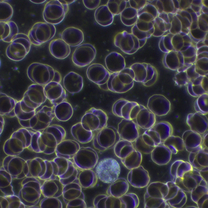 Live Blood Analysis Microscopes