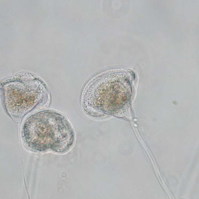 How to identify wastewater treatment microorganisms under the microscope