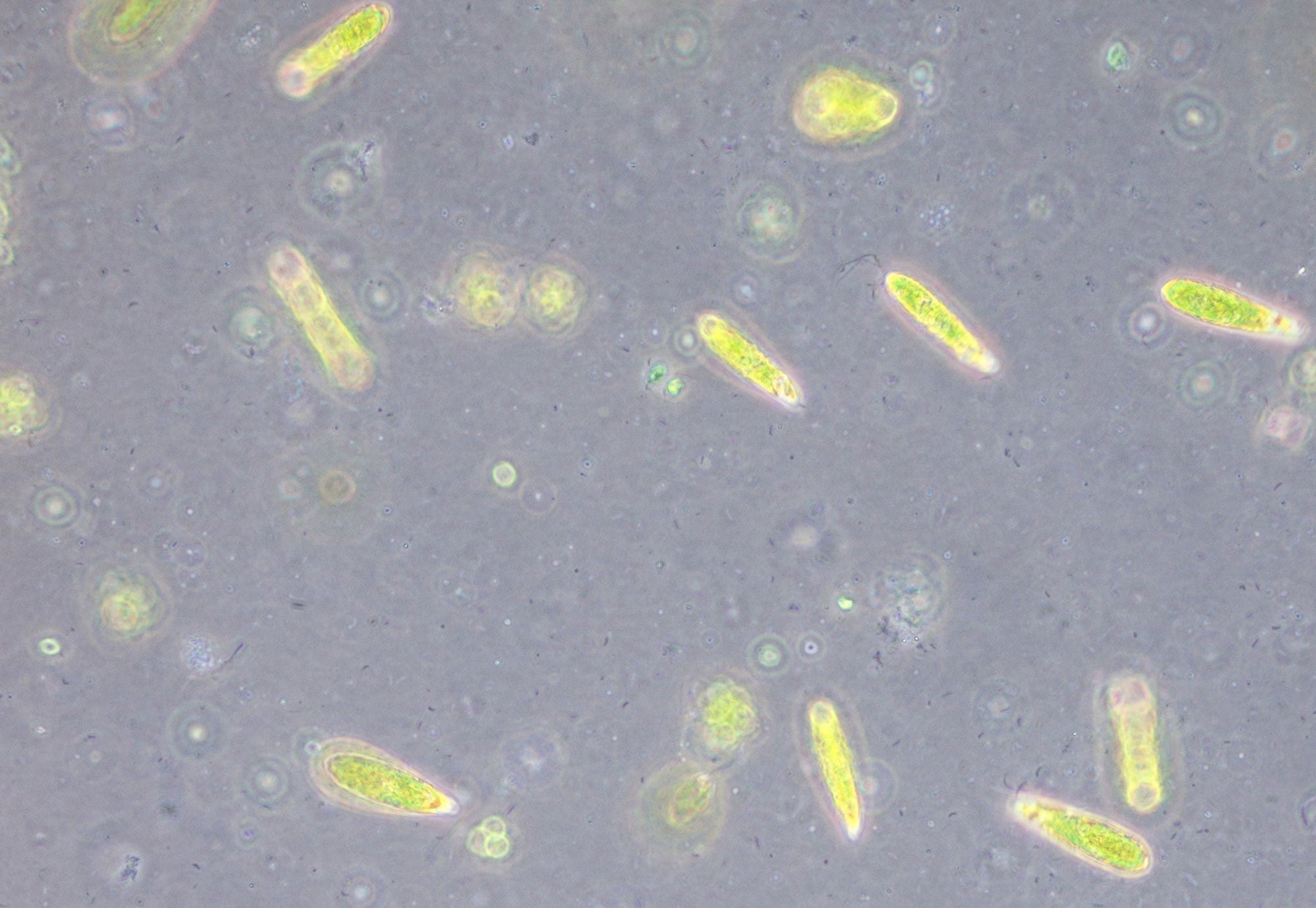 Bacteria under the microscope: a closer look