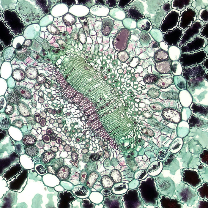 What to consider when buying a digital microscope camera