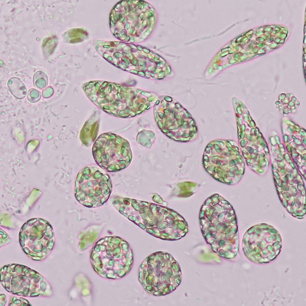Protococcusa Under Microscope What types of microbes might you see under a microscope in compost tea ...