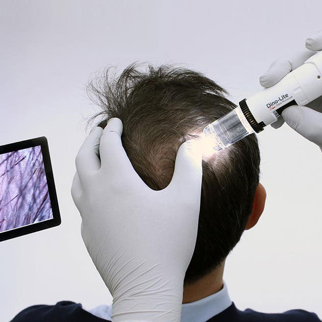 Hair analysis under the microscope
