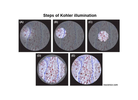 What is Koehler illumination?