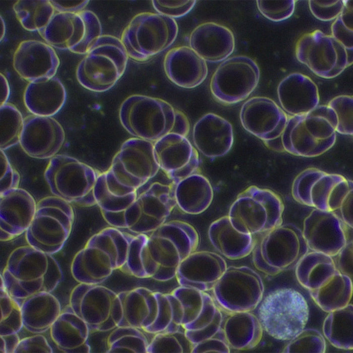 Buying advice for a live blood analysis microscope