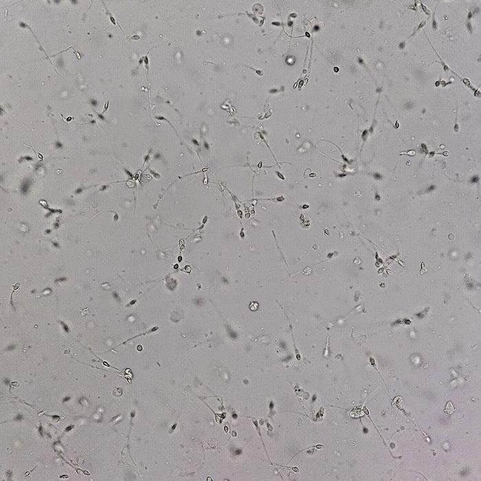 What type of microscope is required to evaluate sperm motility?