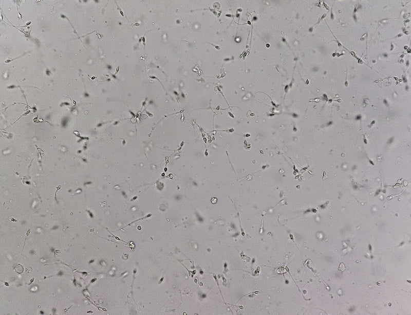 Sparm Microscope Sperm Microscope 400x