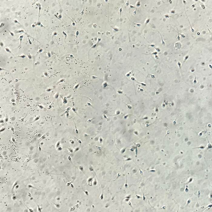 Phase Contrast Microscope for Semen Analysis