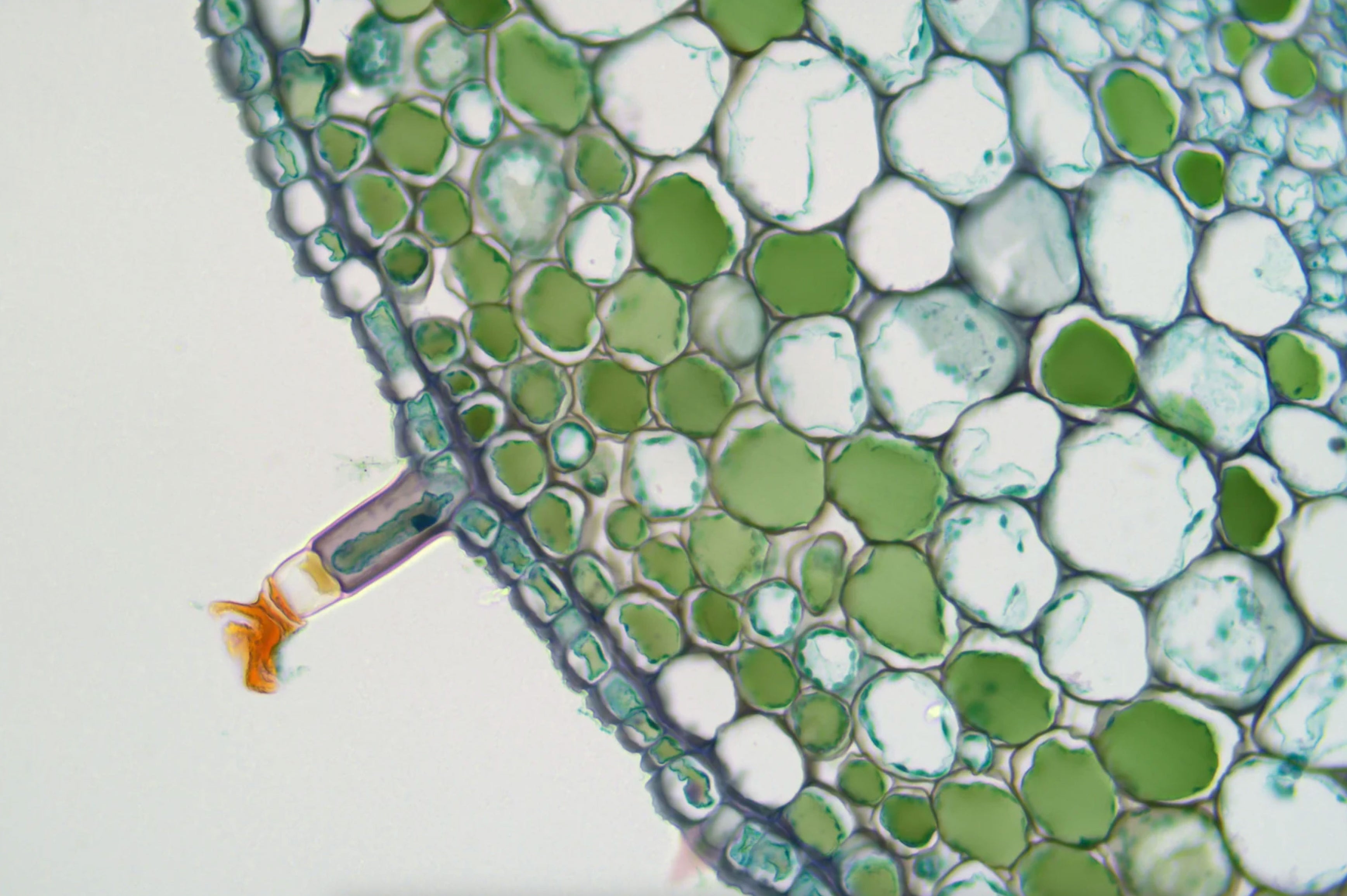 Professional Upright Biological Microscope & Digital Camera ...