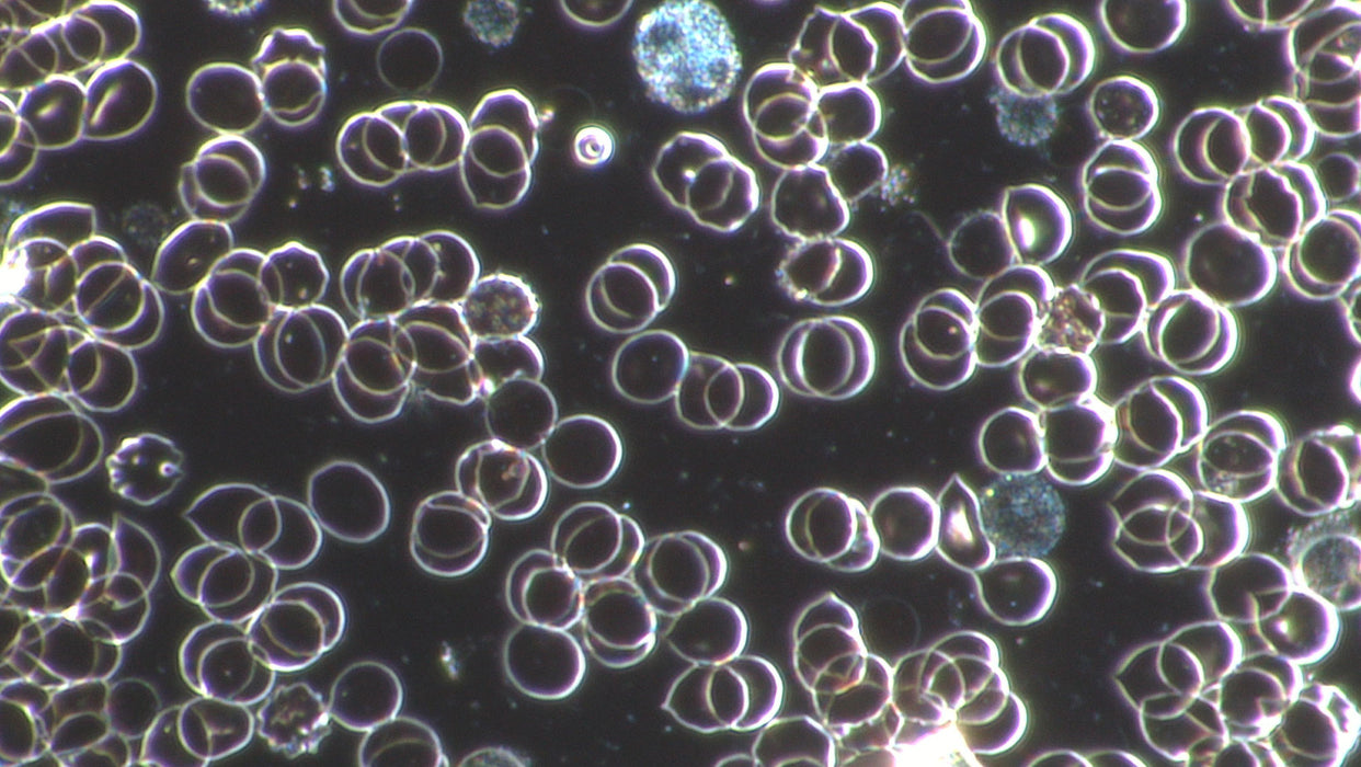Professional Live Blood Analysis Microscope