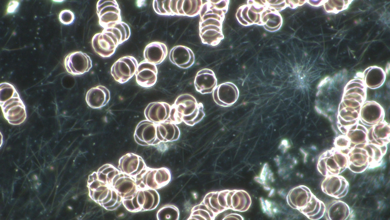 Professional Live Blood Analysis Microscope