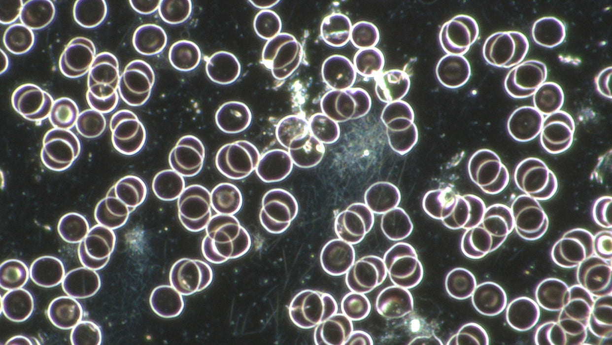 Professional Live Blood Analysis Microscope