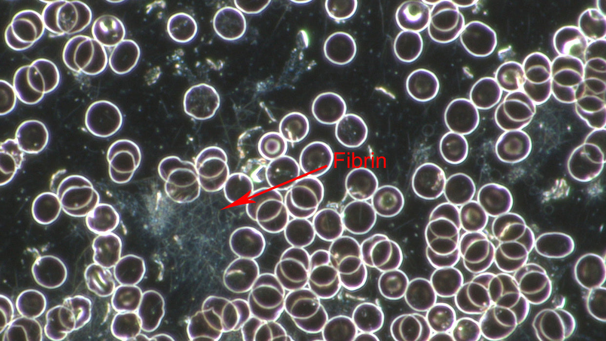 Professional Live Blood Analysis Microscope
